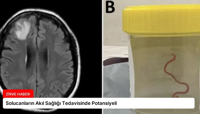 Solucanların Akıl Sağlığı Tedavisinde Potansiyeli