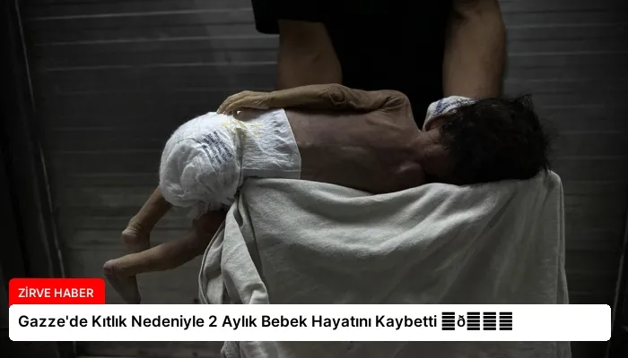 Gazze’de Kıtlık Nedeniyle 2 Aylık Bebek Hayatını Kaybetti ⏬👇